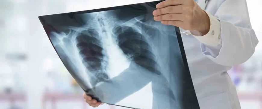 Uzmanlardan Zatürre Uyarısı: Hemen Doktora Gidilmeli